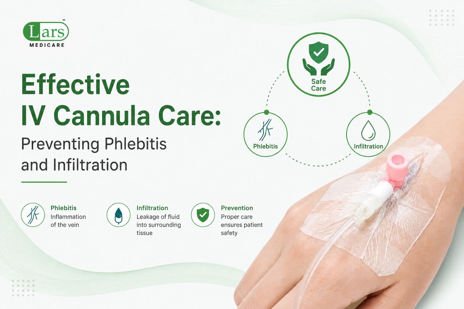 Effective IV Cannula Care: Preventing Phlebitis and Infiltration